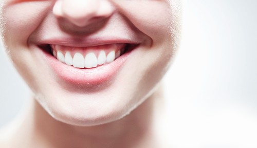 Sorriso gengival